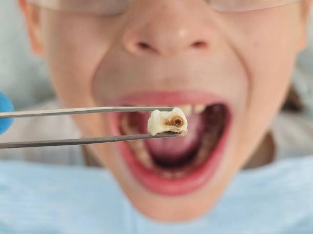 Best Tooth Infection Emergency Dentist  in Osceola, AR